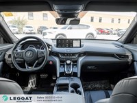 2025 Acura TLX A-Spec SH-AWD Sedan