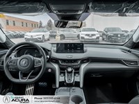 2025 Acura TLX A-Spec SH-AWD Sedan