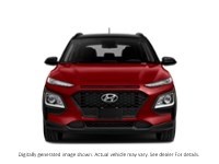 2018 Hyundai Kona 2.0L Luxury AWD Exterior Shot 5