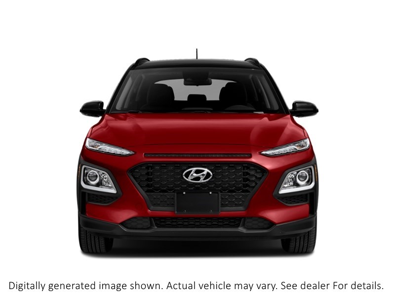 2018 Hyundai Kona 2.0L Luxury AWD Exterior Shot 5
